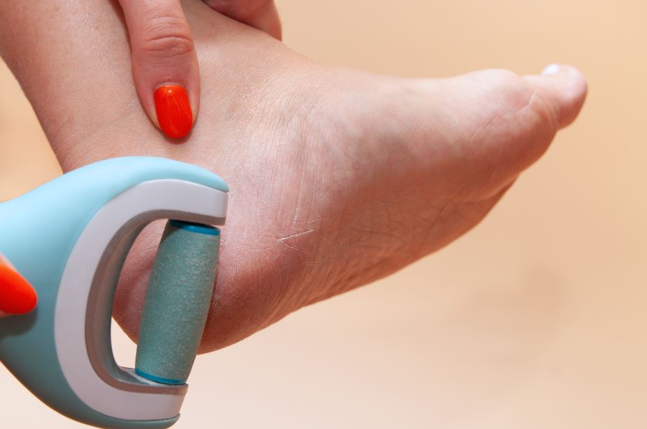 Pilă electrică utilizată pe călcâi - Cea mai bună pilă electrică pentru călcâie - Ghid de alegere